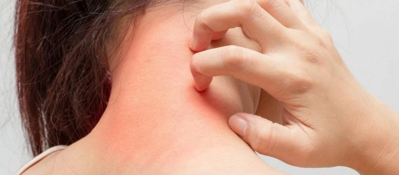 Αυτές είναι οι 8 σοβαρές ασθένειες που εκδηλώνονται πρώτα στο δέρμα